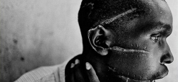 Trpěl za svůj názor a jeho jizvy pak otočily oči světa k běsnění ve Rwandě